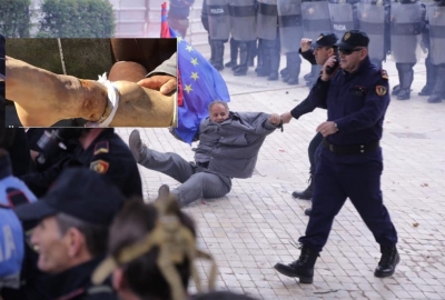 VIDEO/ Sandër Lleshaj shikoje këmbën e Gjergj Çunit, invalidit që dhunove sot në protestë