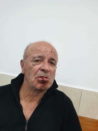 80-vjeçari i dhunuar nga policia, turp për të gjithë klasën politike!