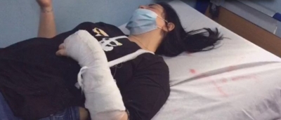 Rrihet brutalisht dhe i thyhet krahu aktivistes së PD nga shefi i komisariatit