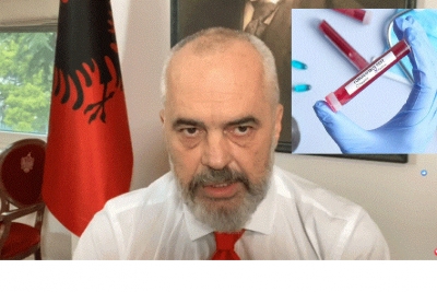 Të fundit edhe në testimet për COVID-19/ Shqipëria përkrah Etiopisë dhe Xhibutit
