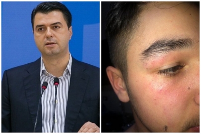 Policia dhunoi të miturin në Tiranë, Basha poston videon: Kjo është fytyra e shtetit të Ramës