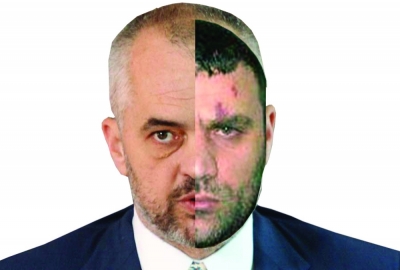 Shullazi ndjek shembullin e Ramës, letër publike për OMN-në